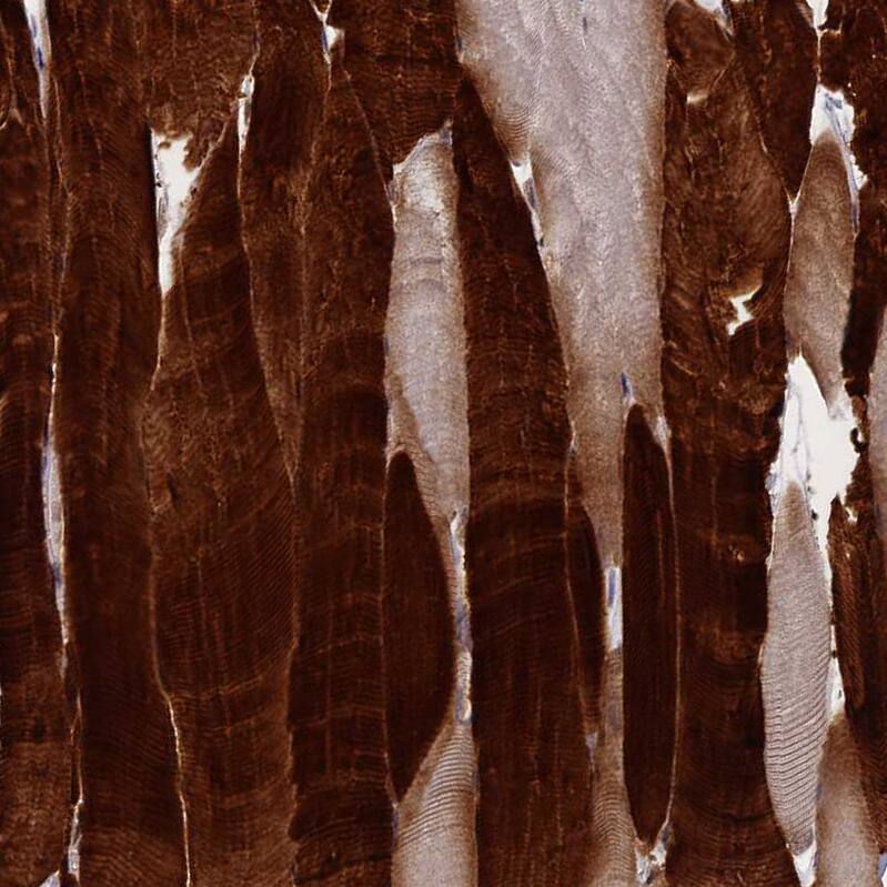 Troponin T Type 3 (fast skeletal) Antibody - BSA Free Immunohistochemistry: Troponin T Type 3 (fast skeletal) Antibody - BSA Free [NBP1-92534]