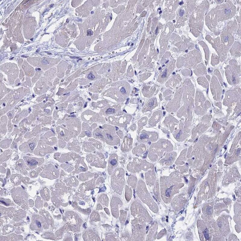 Troponin T Type 3 (fast skeletal) Antibody - BSA Free Immunohistochemistry: Troponin T Type 3 (fast skeletal) Antibody - BSA Free [NBP1-92534]