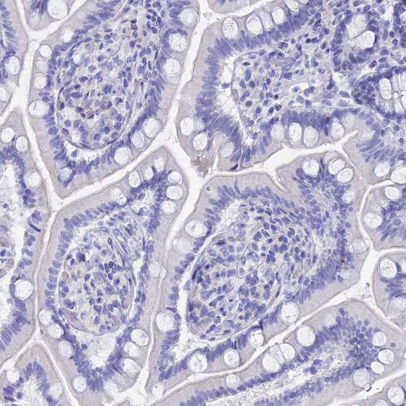 Troponin T Type 3 (fast skeletal) Antibody - BSA Free Immunohistochemistry: Troponin T Type 3 (fast skeletal) Antibody - BSA Free [NBP1-92534]