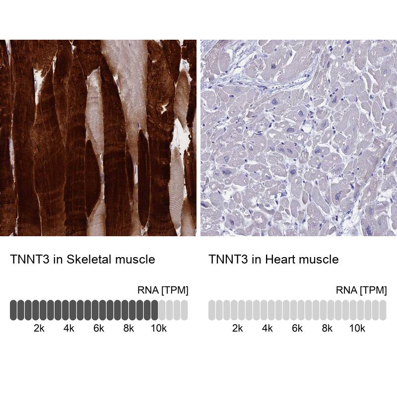 Troponin T Type 3 (fast skeletal) Antibody - BSA Free Immunohistochemistry: Troponin T Type 3 (fast skeletal) Antibody - BSA Free [NBP1-92534]