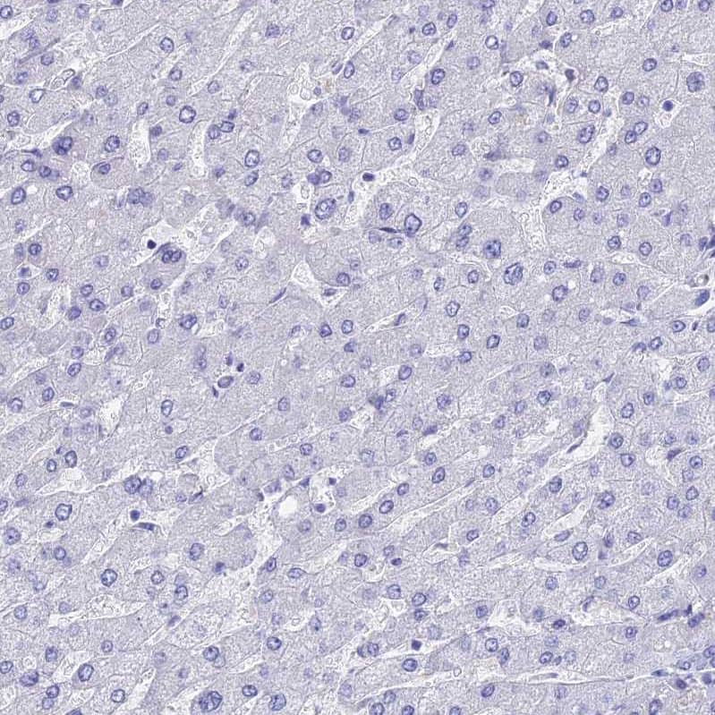 Troponin T Type 3 (fast skeletal) Antibody - BSA Free Immunohistochemistry: Troponin T Type 3 (fast skeletal) Antibody - BSA Free [NBP1-92534]