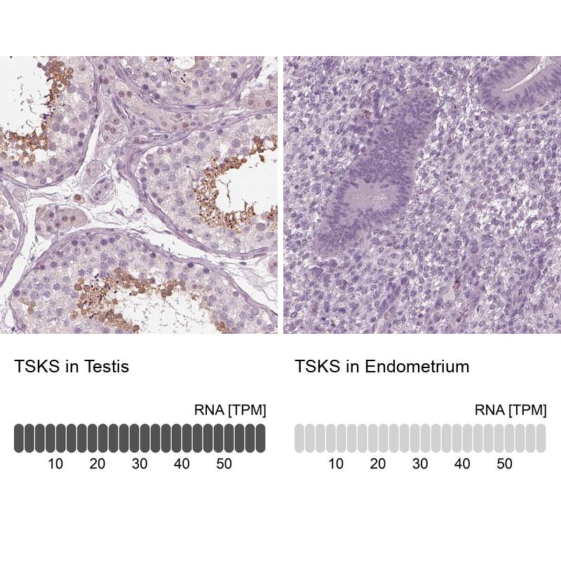 TSKS Antibody - BSA Free Immunohistochemistry: TSKS Antibody - BSA Free [NBP1-92539]