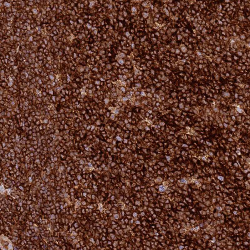 TTPAL Antibody - BSA Free Immunohistochemistry: TTPAL Antibody - BSA Free [NBP1-92544]