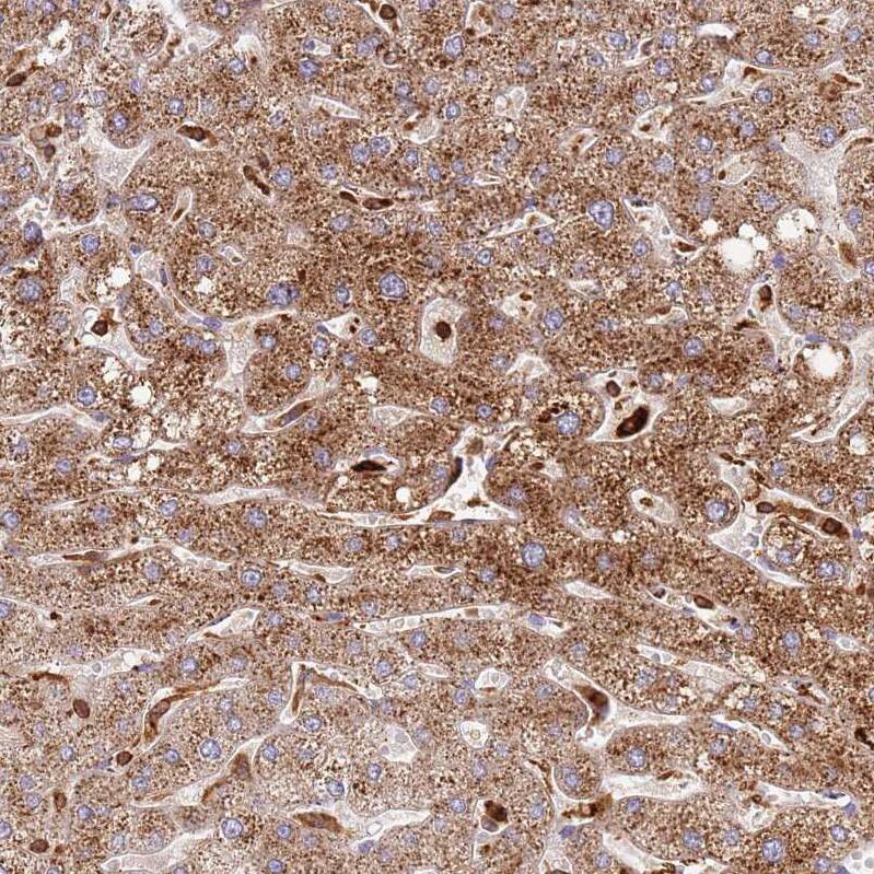 TTPAL Antibody - BSA Free Immunohistochemistry: TTPAL Antibody - BSA Free [NBP1-92544]