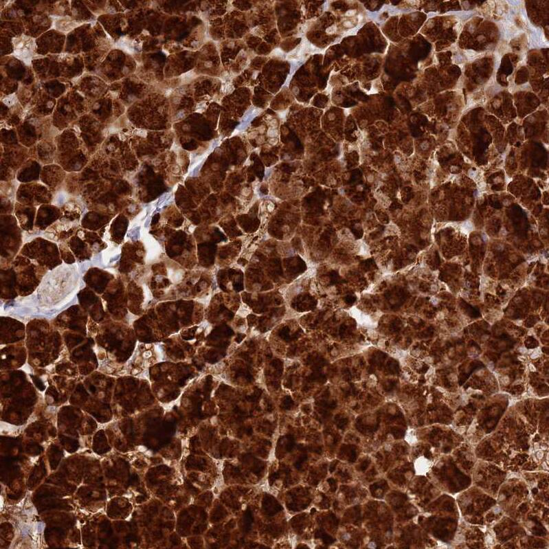 TTPAL Antibody - BSA Free Immunohistochemistry: TTPAL Antibody - BSA Free [NBP1-92544]