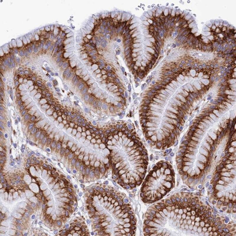TUBGCP6 Antibody - BSA Free Immunohistochemistry: TUBGCP6 Antibody - BSA Free [NBP1-92548]