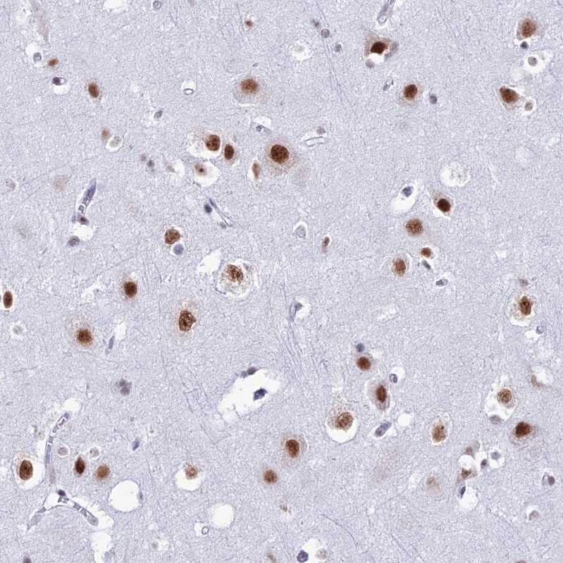 U2AF35 Antibody - BSA Free Immunohistochemistry: U2AF35 Antibody - BSA Free [NBP1-92553]