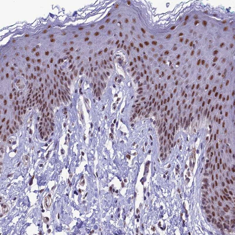 U2AF35 Antibody - BSA Free Immunohistochemistry: U2AF35 Antibody - BSA Free [NBP1-92553]