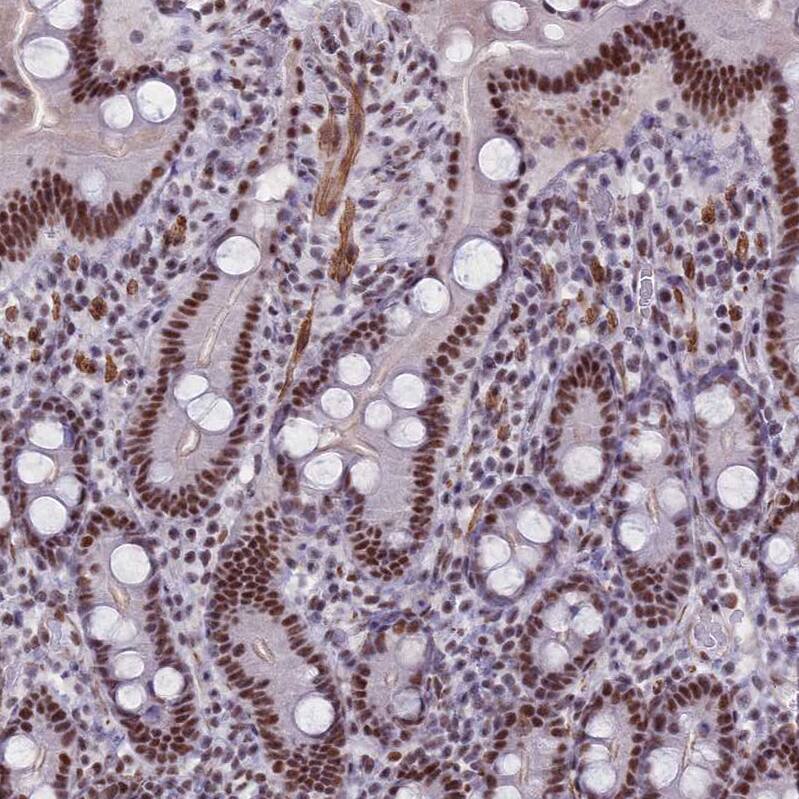 U2AF35 Antibody - BSA Free Immunohistochemistry: U2AF35 Antibody - BSA Free [NBP1-92553]