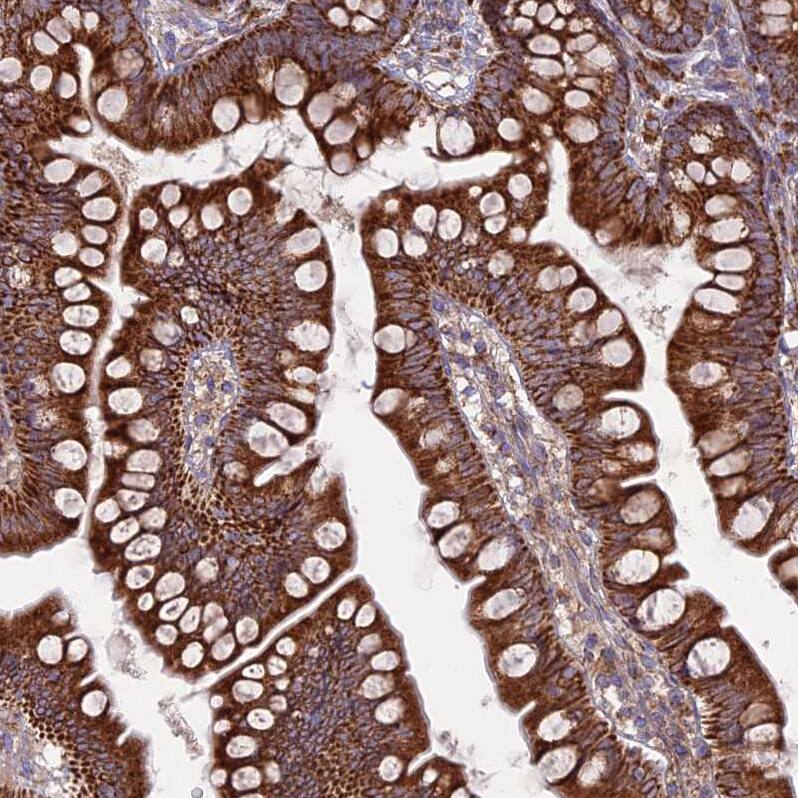 UAP1L1 Antibody - BSA Free Immunohistochemistry: UAP1L1 Antibody - BSA Free [NBP1-92555]