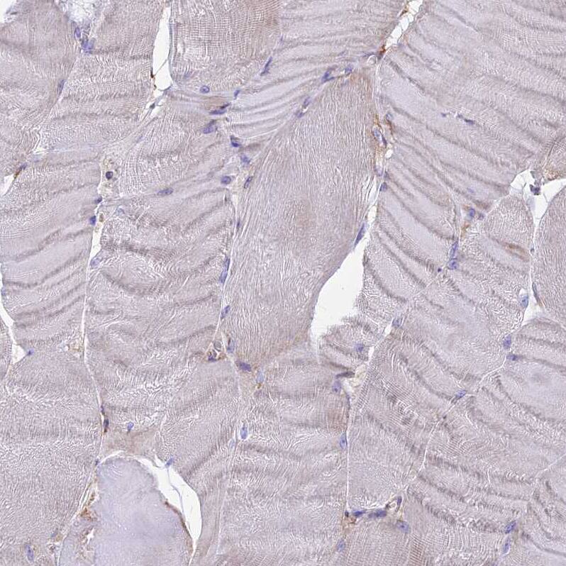 UAP1L1 Antibody - BSA Free Immunohistochemistry: UAP1L1 Antibody - BSA Free [NBP1-92555]