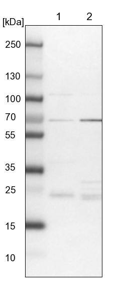 UBE2E2 Antibody - BSA Free Western Blot: UBE2E2 Antibody - BSA Free [NBP1-92556]