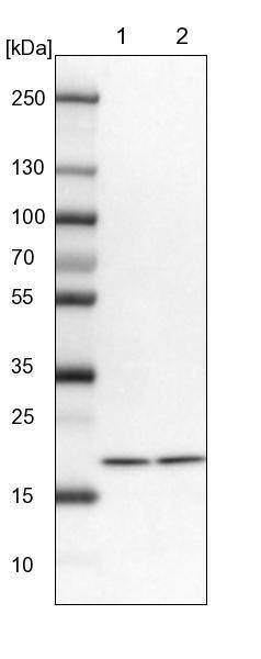 UbcH7/UBE2L3 Antibody - BSA Free Western Blot: UbcH7/UBE2L3 Antibody - BSA Free [NBP1-92557]