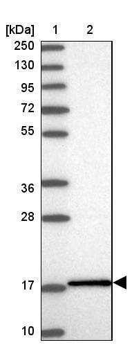 UbcH7/UBE2L3 Antibody - BSA Free Western Blot: UbcH7/UBE2L3 Antibody - BSA Free [NBP1-92557]
