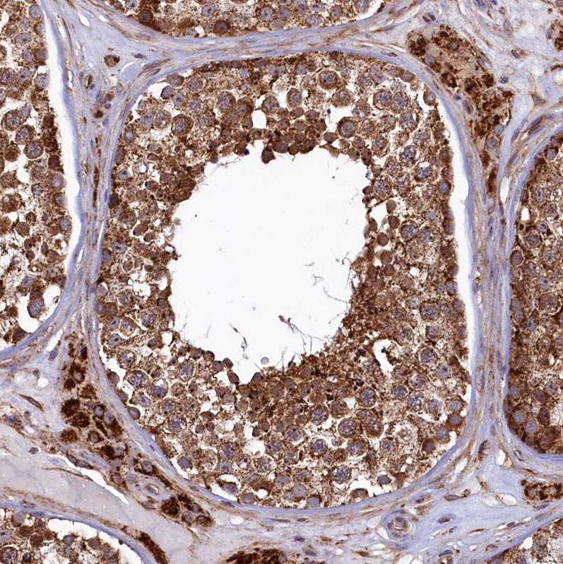 UBE3B Antibody - BSA Free Immunohistochemistry-Paraffin: UBE3B Antibody [NBP1-92559]