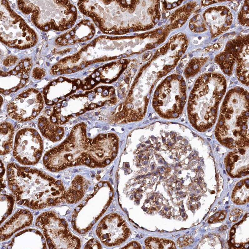 UBE3B Antibody - BSA Free Immunohistochemistry-Paraffin: UBE3B Antibody [NBP1-92559]
