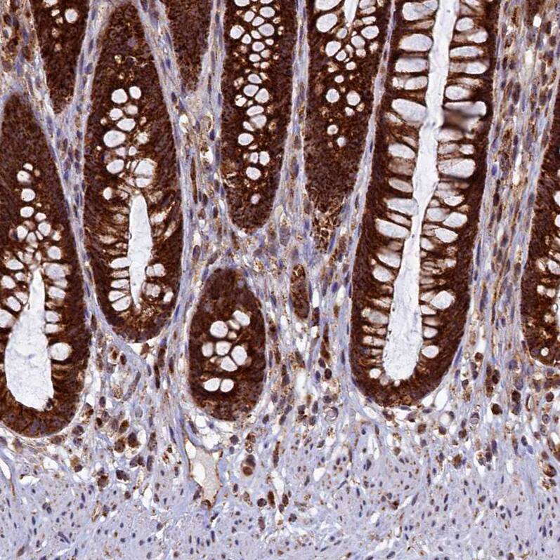 UBE3B Antibody - BSA Free Immunohistochemistry-Paraffin: UBE3B Antibody [NBP1-92559]
