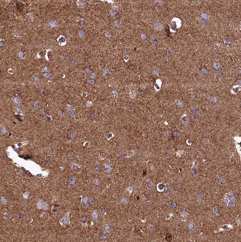 UBE3B Antibody - BSA Free Immunohistochemistry-Paraffin: UBE3B Antibody [NBP1-92559]