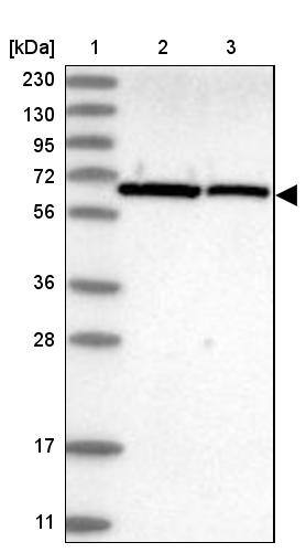 UBXD2 Antibody - BSA Free Western Blot: UBXD2 Antibody - BSA Free [NBP1-92560]