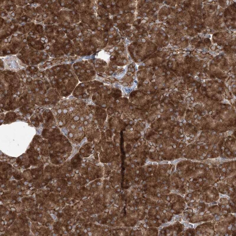 UBXD2 Antibody - BSA Free Immunohistochemistry: UBXD2 Antibody - BSA Free [NBP1-92560]