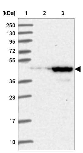 UEVLD Antibody - BSA Free Western Blot: UEVLD Antibody - BSA Free [NBP1-92561]