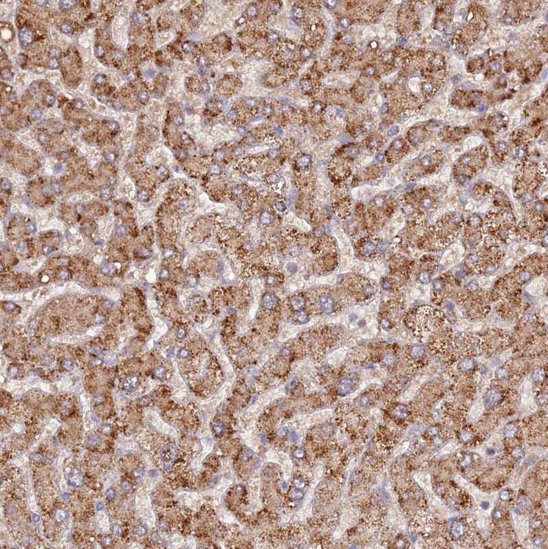 UQCRQ Antibody - BSA Free Immunohistochemistry: UQCRQ Antibody - BSA Free [NBP1-92563]
