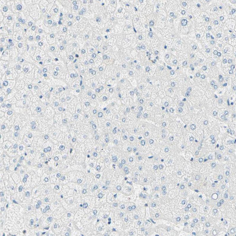 Uroplakin IIIB Antibody - BSA Free Immunohistochemistry: Uroplakin IIIB Antibody - BSA Free [NBP1-92564]