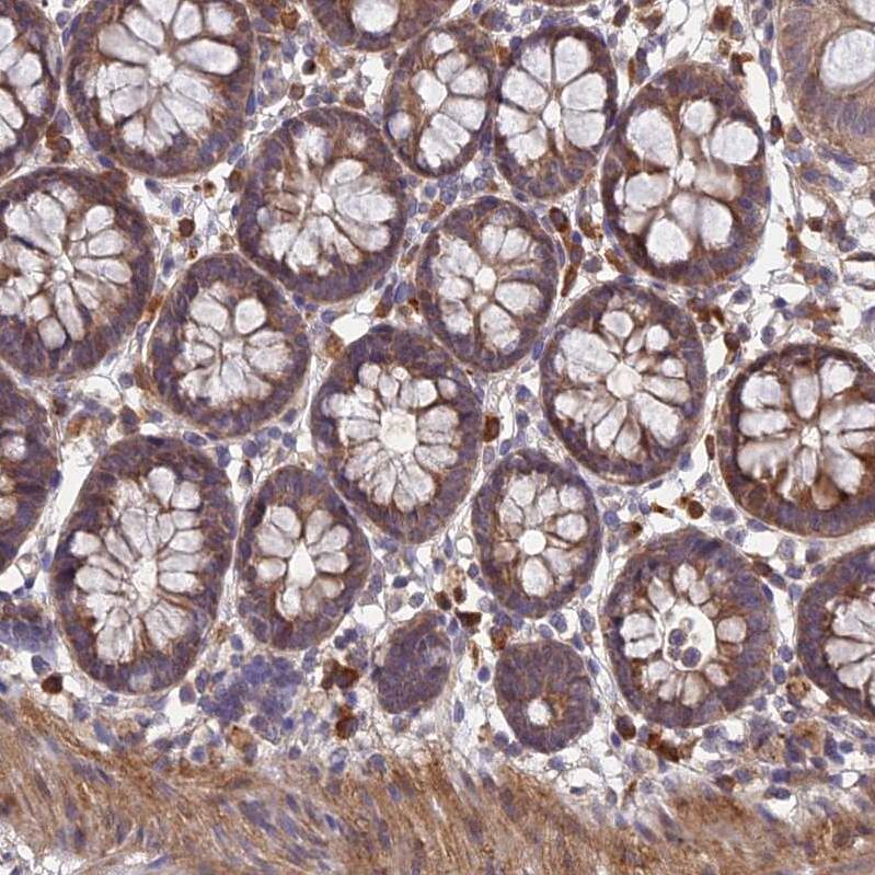 UROS Antibody - BSA Free Immunohistochemistry: UROS Antibody - BSA Free [NBP1-92565]