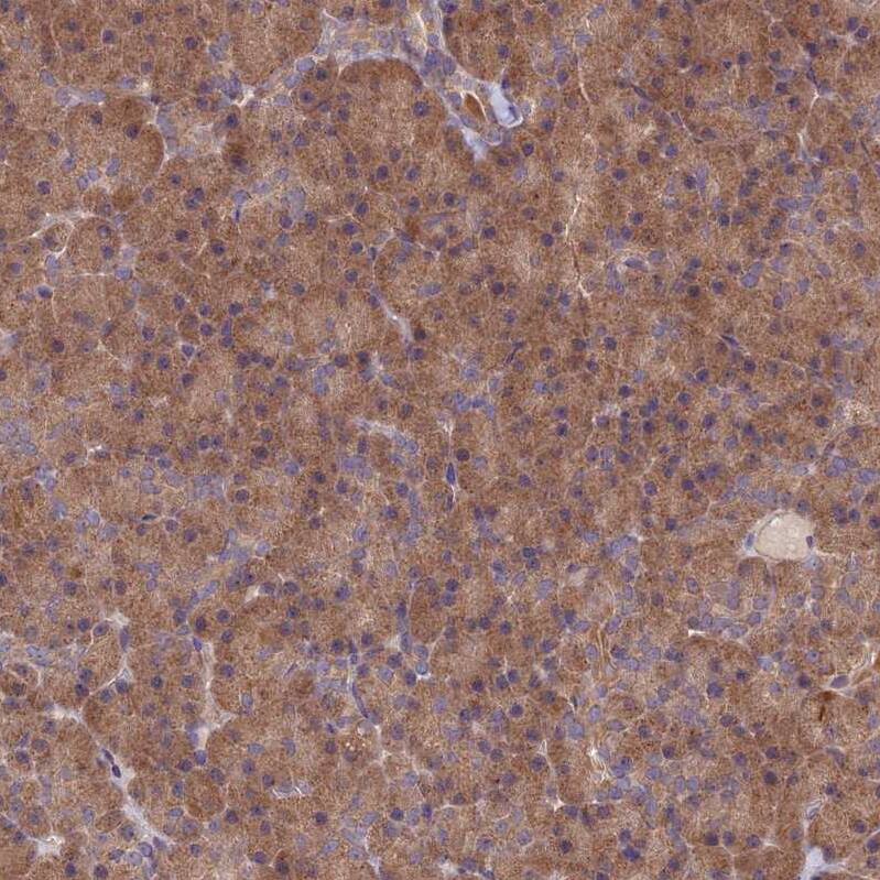 UROS Antibody - BSA Free Immunohistochemistry: UROS Antibody - BSA Free [NBP1-92565]