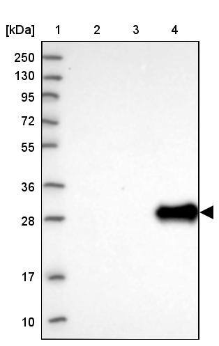 UTP11L Antibody - BSA Free Western Blot: UTP11L Antibody - BSA Free [NBP1-92567]