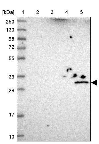UTP23 Antibody - BSA Free Western Blot: UTP23 Antibody - BSA Free [NBP1-92568]