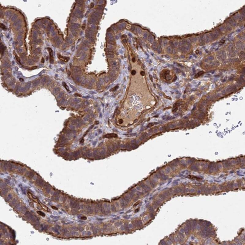 VEST1 Antibody - BSA Free Immunohistochemistry: VEST1 Antibody - BSA Free [NBP1-92571]