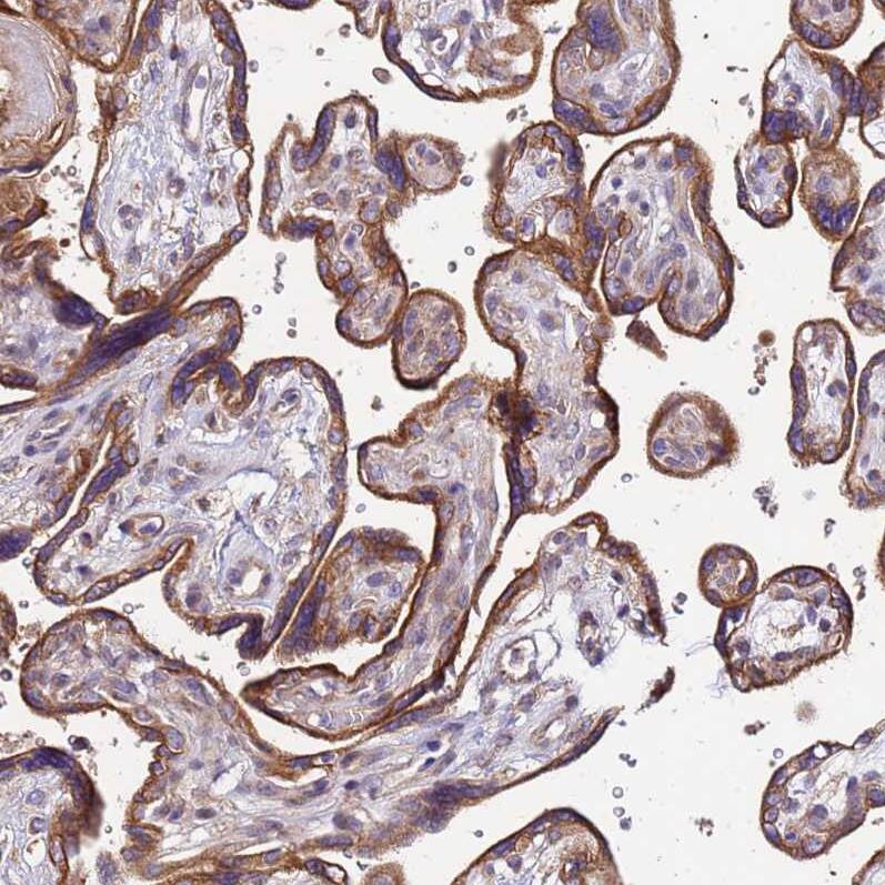 VMO1 Antibody - BSA Free Immunohistochemistry: VMO1 Antibody - BSA Free [NBP1-92574]