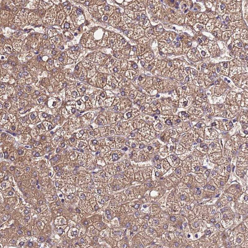 VMO1 Antibody - BSA Free Immunohistochemistry: VMO1 Antibody - BSA Free [NBP1-92574]