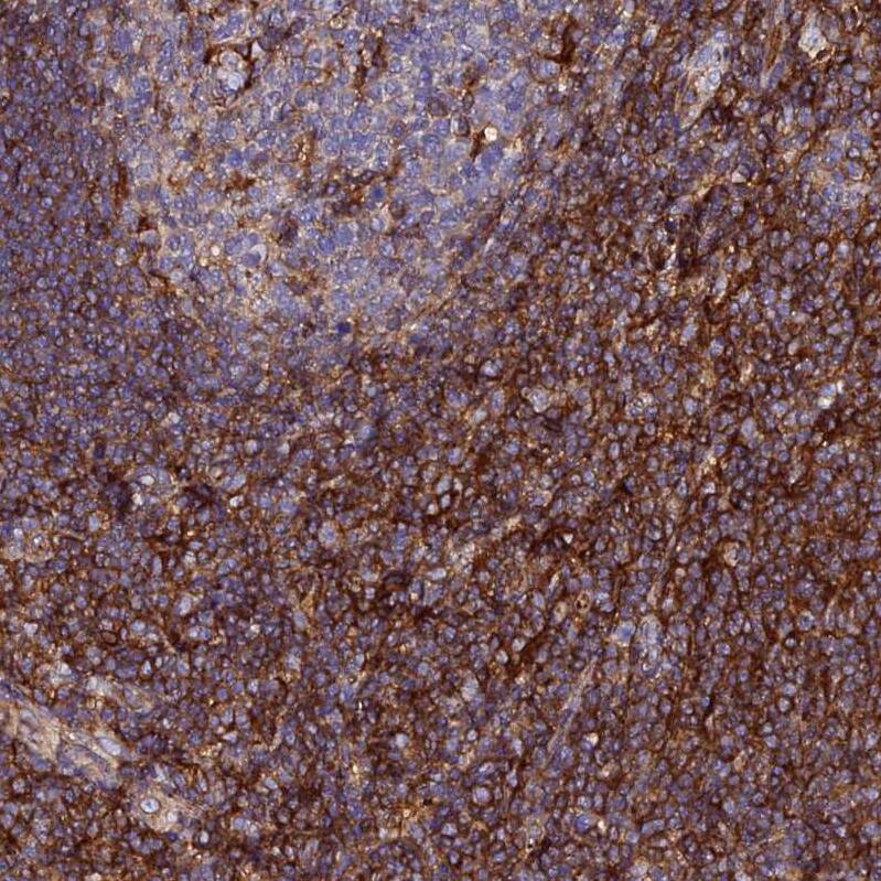 VRL1 Antibody - BSA Free Immunohistochemistry: VRL1 Antibody - BSA Free [NBP1-92576]