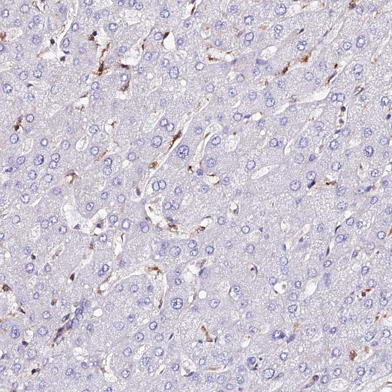 VRL1 Antibody - BSA Free Immunohistochemistry: VRL1 Antibody - BSA Free [NBP1-92576]