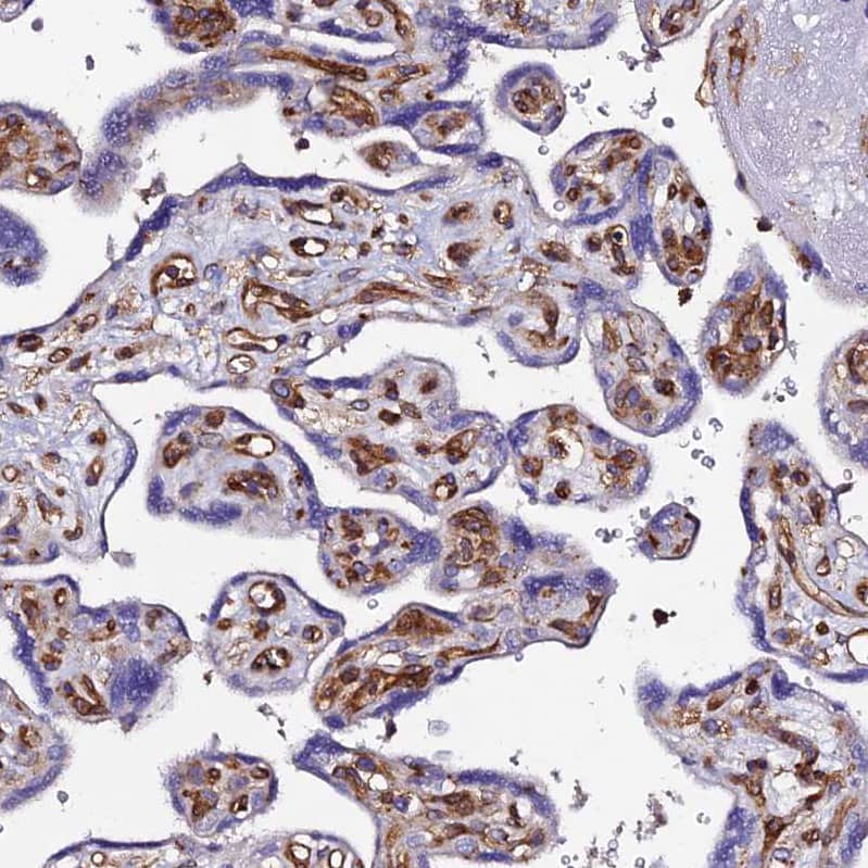 VRL1 Antibody - BSA Free Immunohistochemistry: VRL1 Antibody - BSA Free [NBP1-92576]