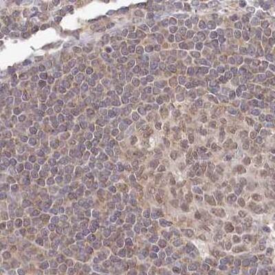 WAPL Antibody - BSA Free Immunohistochemistry: WAPL Antibody - BSA Free [NBP1-92578]