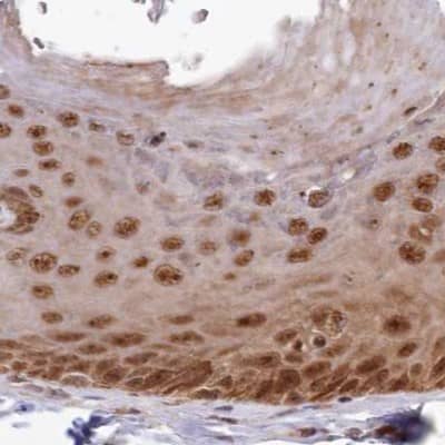 WAPL Antibody - BSA Free Immunohistochemistry-Paraffin: WAPL Antibody [NBP1-92579]