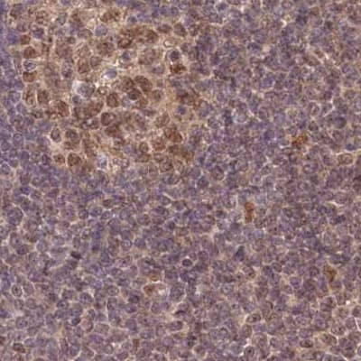 WAPL Antibody - BSA Free Immunohistochemistry-Paraffin: WAPL Antibody [NBP1-92579]