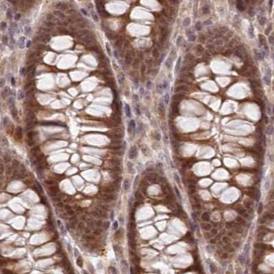 WAPL Antibody - BSA Free Immunohistochemistry-Paraffin: WAPL Antibody [NBP1-92579]