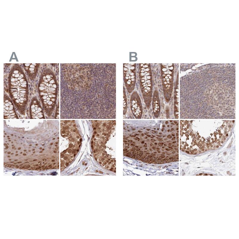 WAPL Antibody - BSA Free Immunohistochemistry-Paraffin: WAPL Antibody [NBP1-92579]