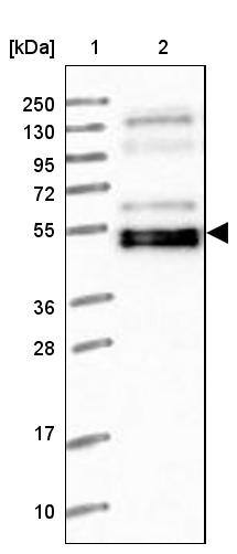 WAPL Antibody - BSA Free Western Blot: WAPL Antibody - BSA Free [NBP1-92579]