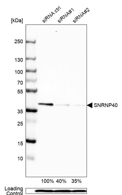 WDR57 Antibody - BSA Free Western Blot: WDR57 Antibody - BSA Free [NBP1-92585]