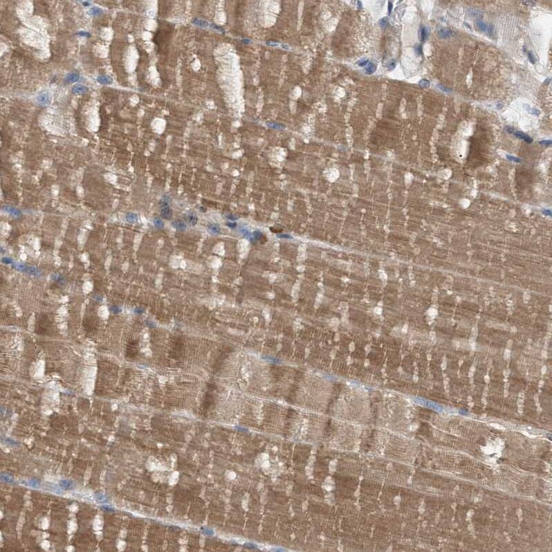 WDR68 Antibody - BSA Free Immunohistochemistry: WDR68 Antibody - BSA Free [NBP1-92589]