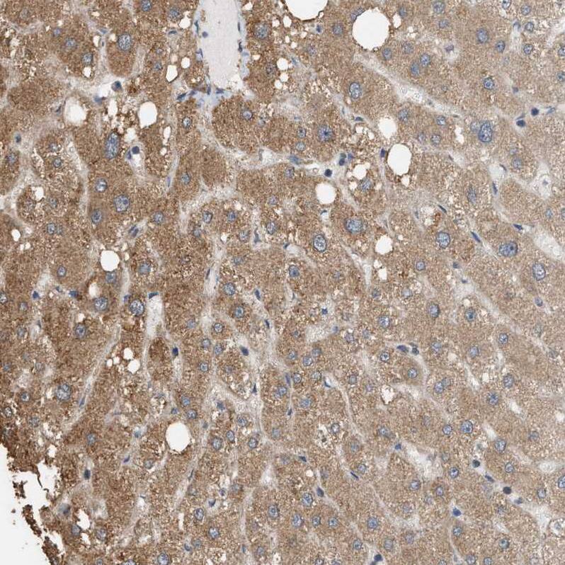 WDR68 Antibody - BSA Free Immunohistochemistry: WDR68 Antibody - BSA Free [NBP1-92589]