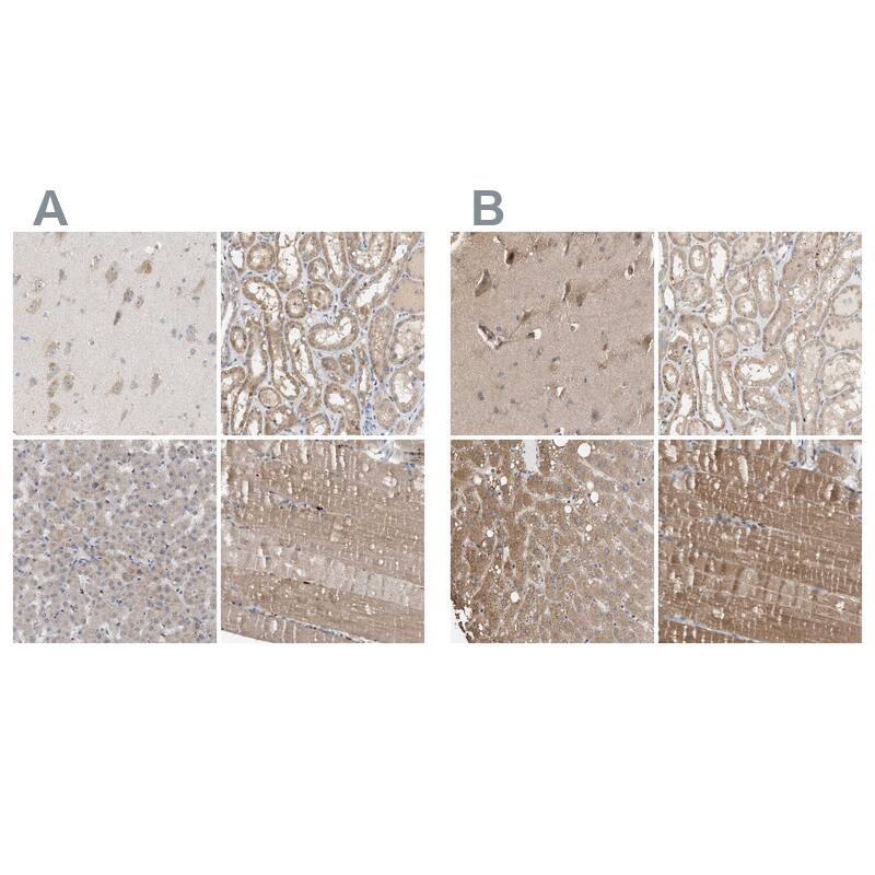 WDR68 Antibody - BSA Free Immunohistochemistry: WDR68 Antibody - BSA Free [NBP1-92590]