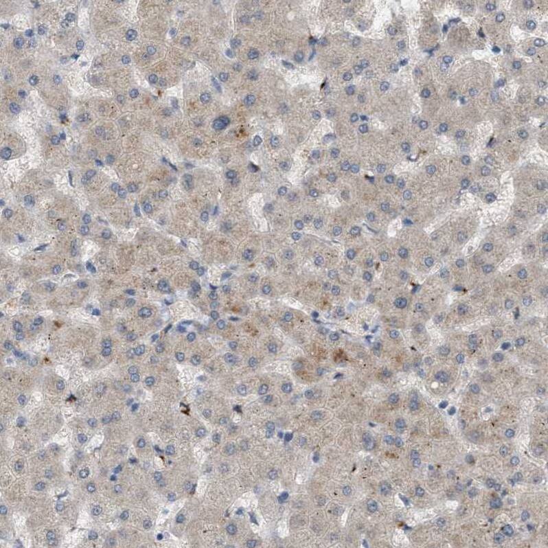 WDR68 Antibody - BSA Free Immunohistochemistry: WDR68 Antibody - BSA Free [NBP1-92590]