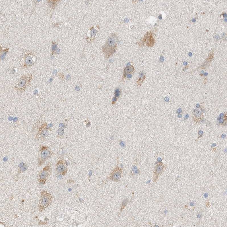 WDR68 Antibody - BSA Free Immunohistochemistry: WDR68 Antibody - BSA Free [NBP1-92590]