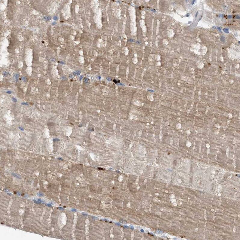 WDR68 Antibody - BSA Free Immunohistochemistry: WDR68 Antibody - BSA Free [NBP1-92590]